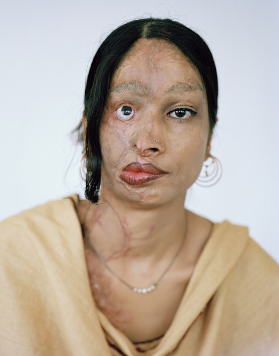 acid attacks, acid violence