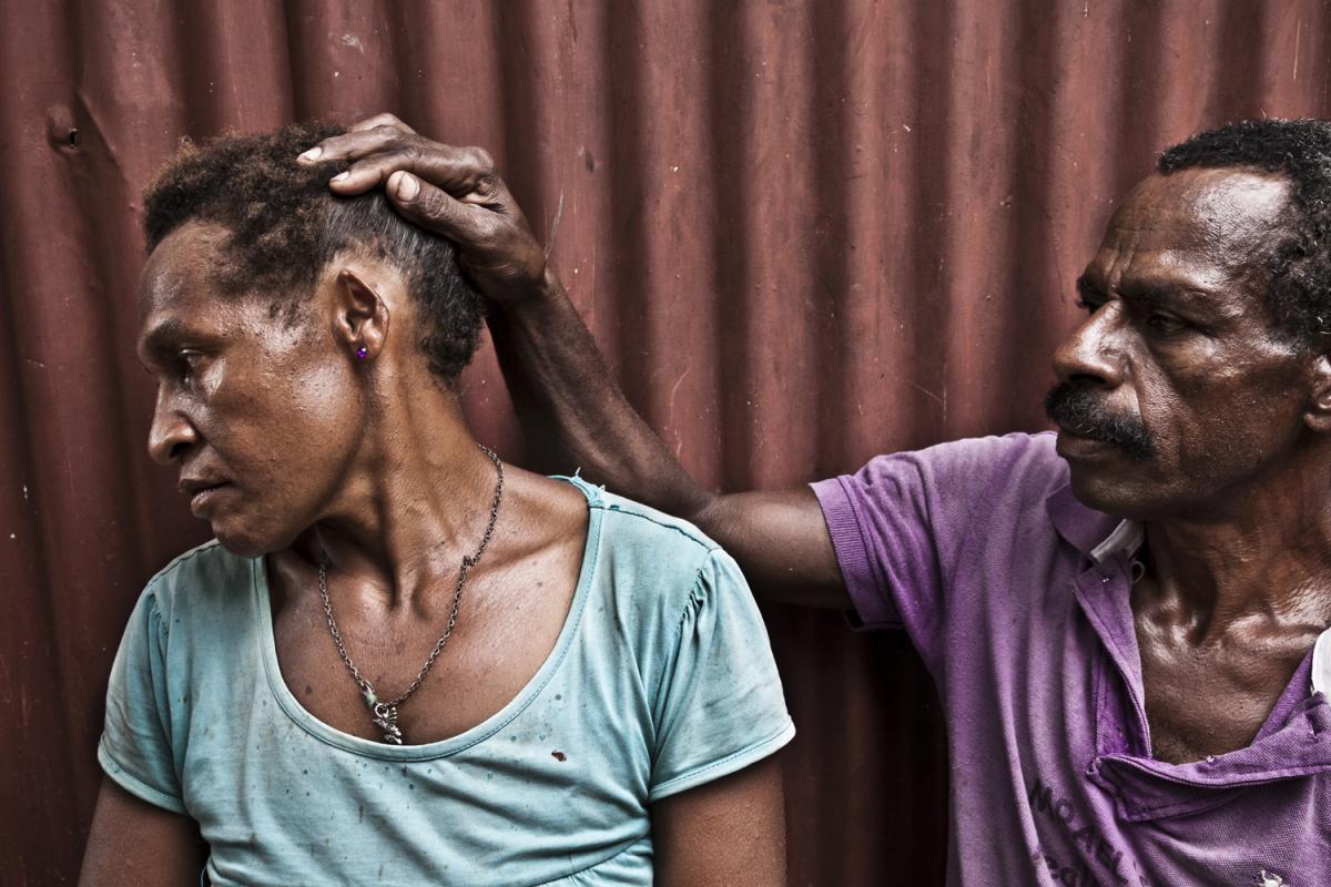 Richard Bal (45) shows disfigured ear of his wife Agita Bal (32) in the Morobe block, Port Moresby.