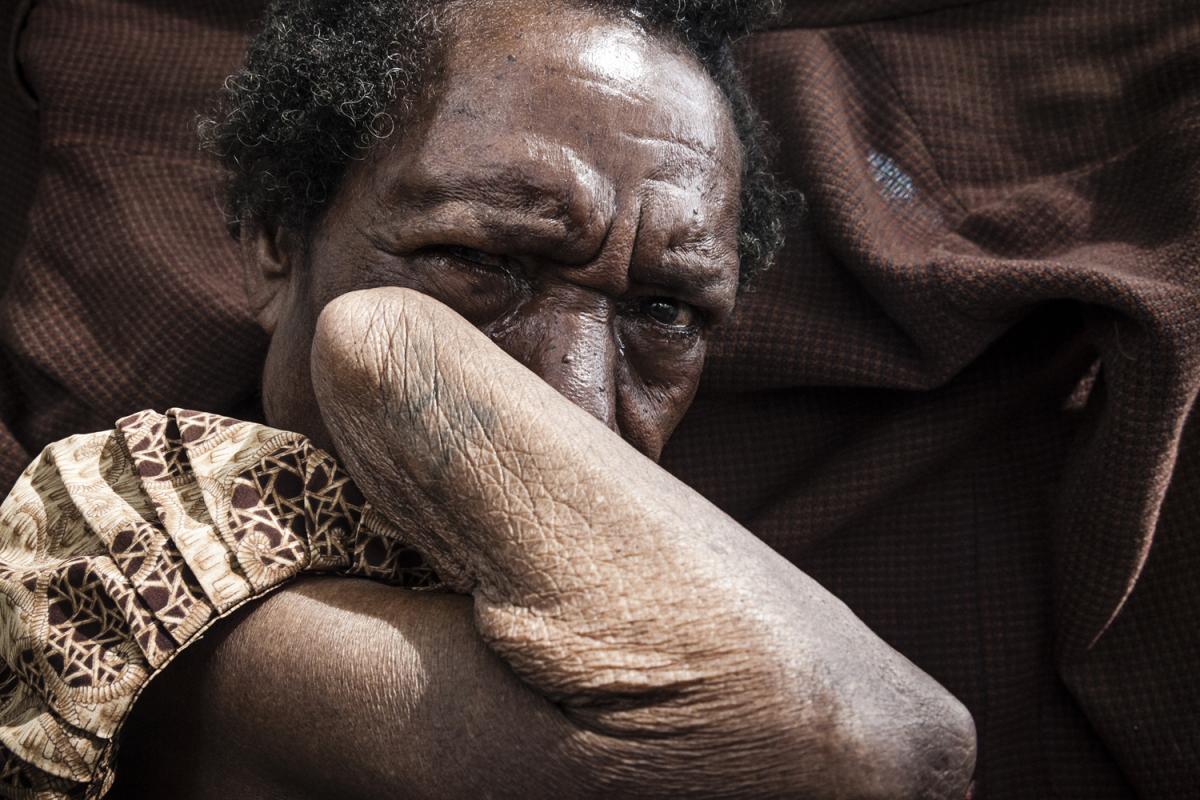 Rasta Twa, a woman survivor of sorcery-related violence.